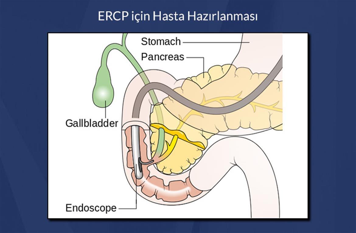 ERCP için Hasta Hazırlığı